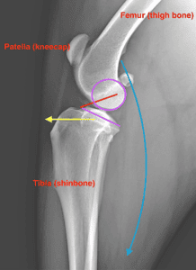 Xray (side view) of dog’s normal knee: