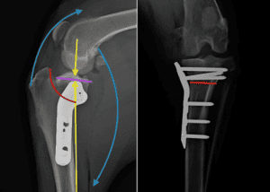 This is a side view (left) and front face (right) X-ray of a dog’s knee AFTER their TPLO procedure.